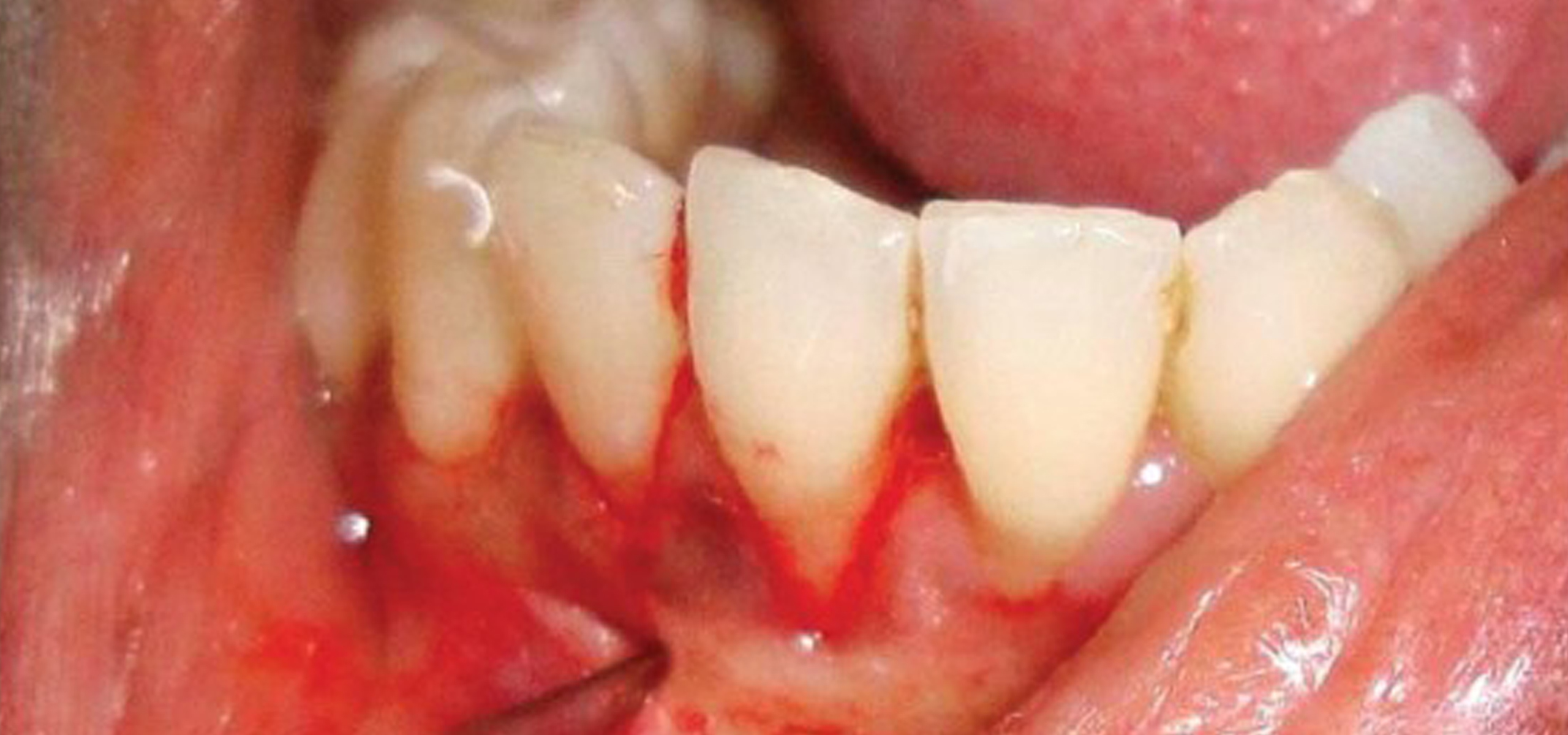 cosmetic dental surgery
